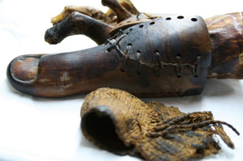 The first prostheses were Egyptian


